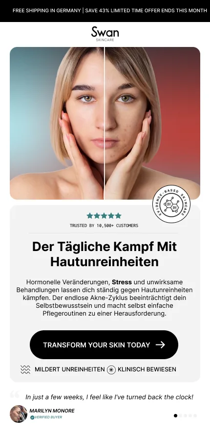 Swan Skincare: Landingpage zu Hautunreinheiten, mobil